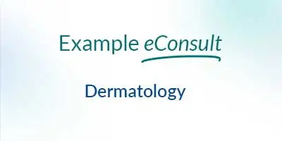 Dermatology Consult – Hidradenitis Suppurativa